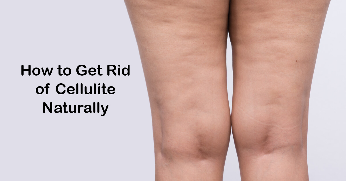 How to reduce cellulite naturally - Quora